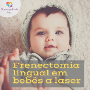 frenectomia lingual em bebês a laser